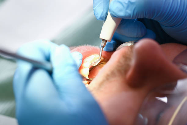 Best Urgent Care for Lost Fillings or Crowns in Lac Du Flambeau, WI