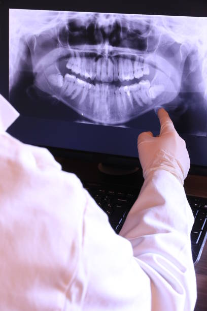 Best Emergency Wisdom Teeth Removal in Lac Du Flambeau, WI